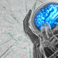 Trauma and the Brain